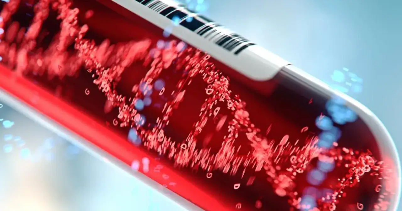 Podwyższony poziom MCV: przyczyny i leczenie tego stanu chorobowego