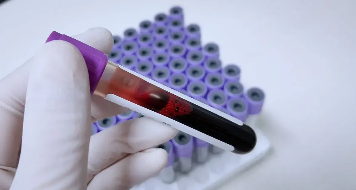 Czy przed badaniem krwi można wypić kawę? Sprawdź, co może zaszkodzić