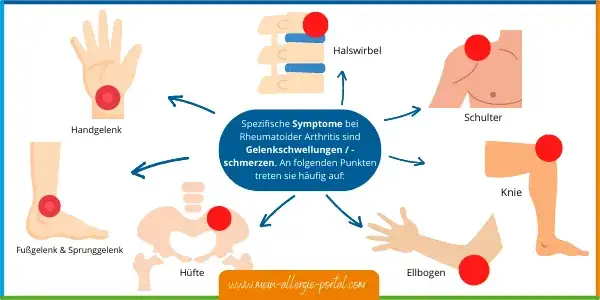 Rheumatoide Arthritis: Diagnose-Schritte & frühe Anzeichen erkennen