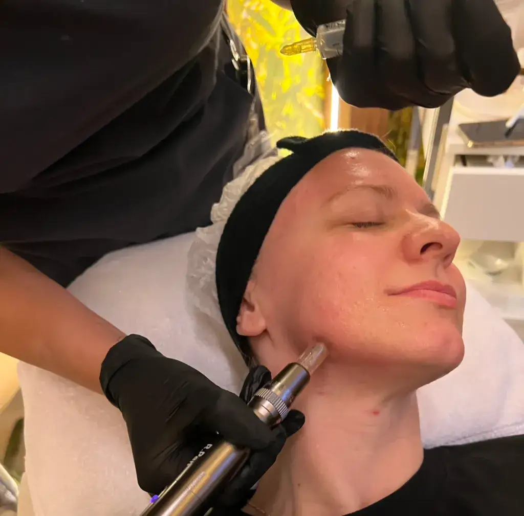 Koktajl Monako – jak odmłodzić skórę i uniknąć efektów starzenia