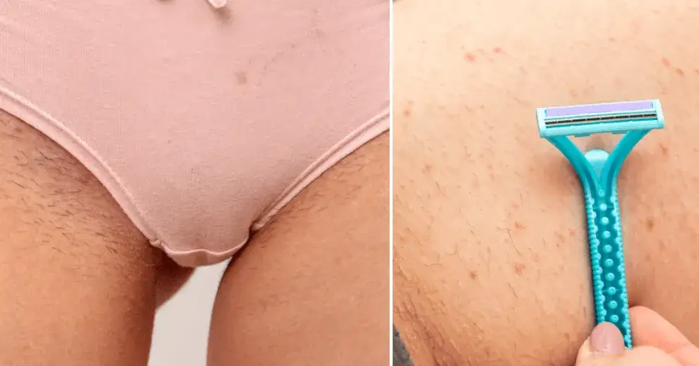 Jak depilować miejsca intymne bez podrażnień i bólu? Sprawdź metody