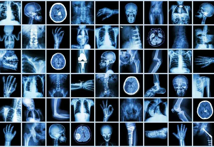 Kto odkrył promienie X i jak zmieniły świat medycyny?