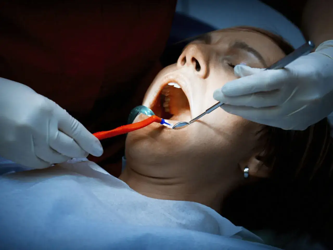 Dentysta bada usta pacjentki, która cierpi na ropień zęba. Widoczne narzędzia stomatologiczne i rozwierak.