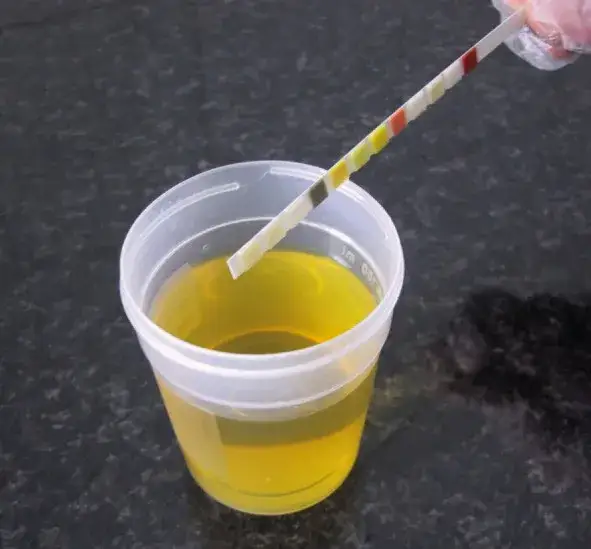 Ile można przechowywać mocz dziecka do badania, aby uniknąć błędów?