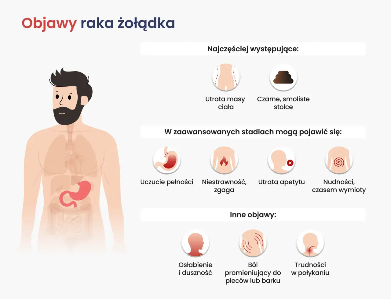 Objawy raka żołądka: utrata masy ciała, czarne stolce, niestrawność, nudności, ból pleców, trudności w połykaniu.