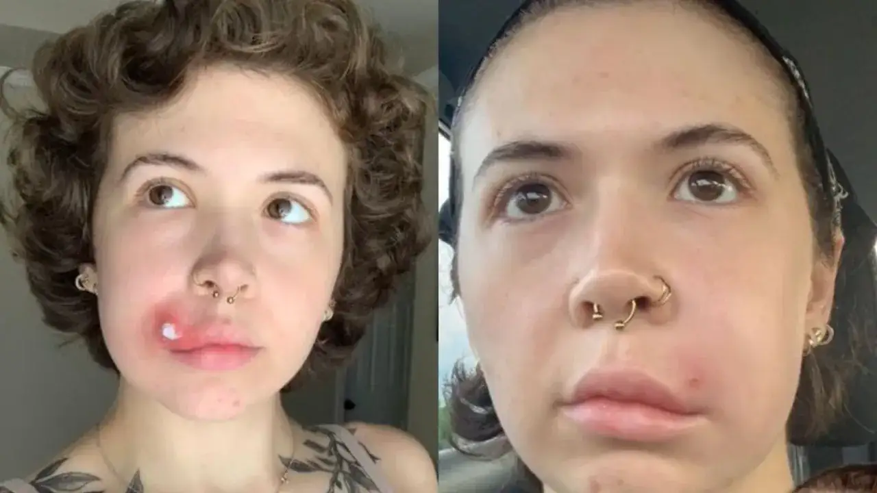 Trójkąt śmierci objawy – nie lekceważ tych groźnych sygnałów