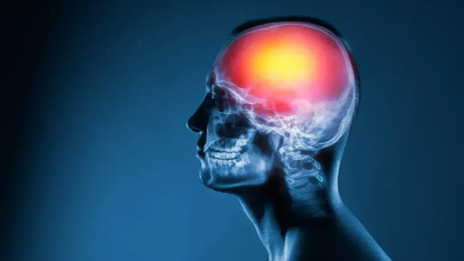 Czy po udarze mózgu można wrócić do pracy? Kluczowe czynniki i porady