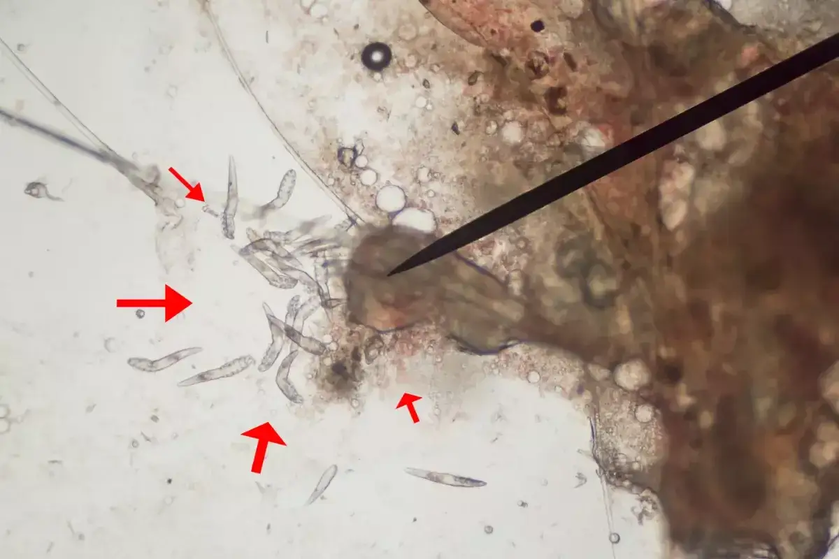 Pies łysieje wokół oczu? Nużyca: Co musisz wiedzieć i jak pomóc
