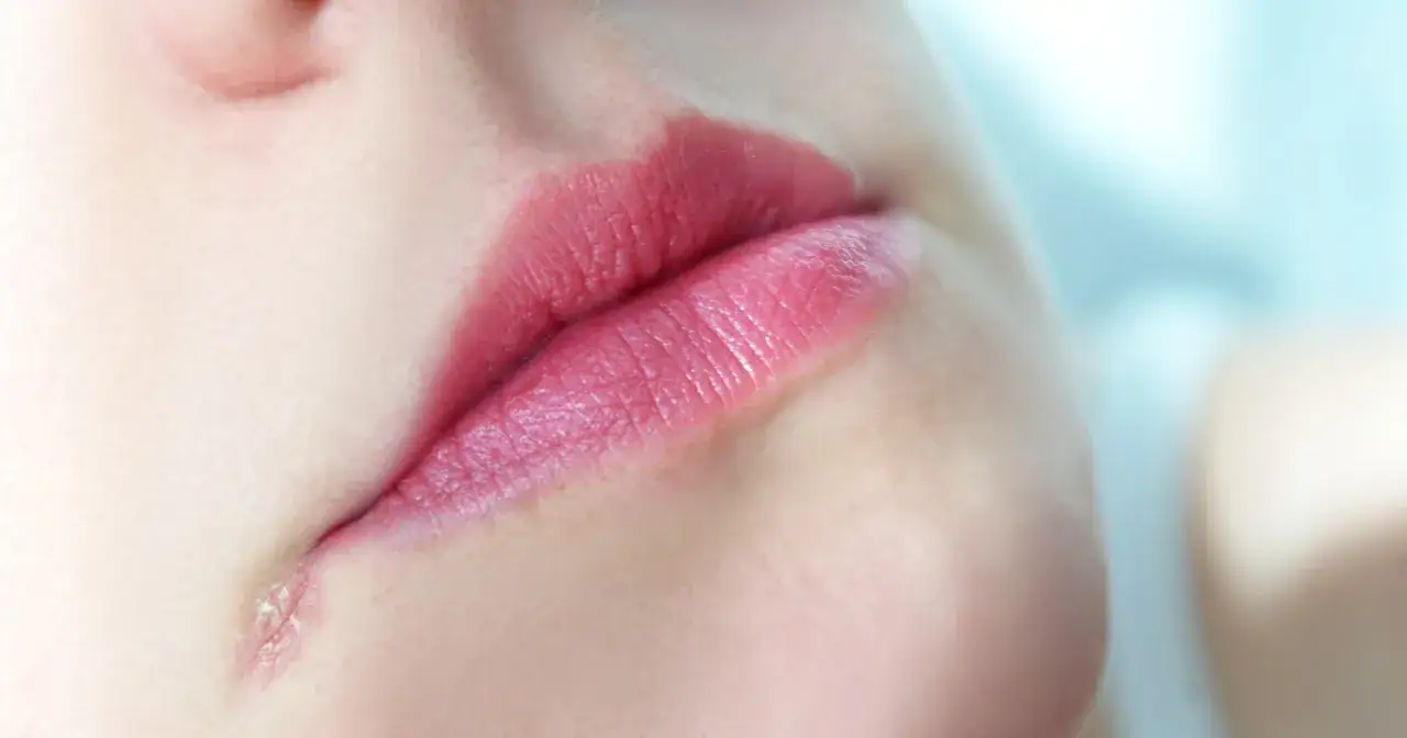 Zbliżenie na usta z różową szminką, widoczne drobne pęknięcia i suchość skóry.