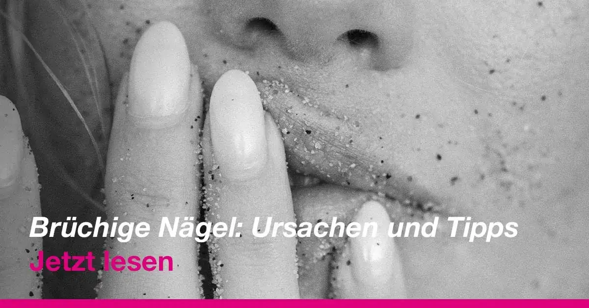 Brüchige Nägel? So stoppen Sie das Splittern Expertentipps
