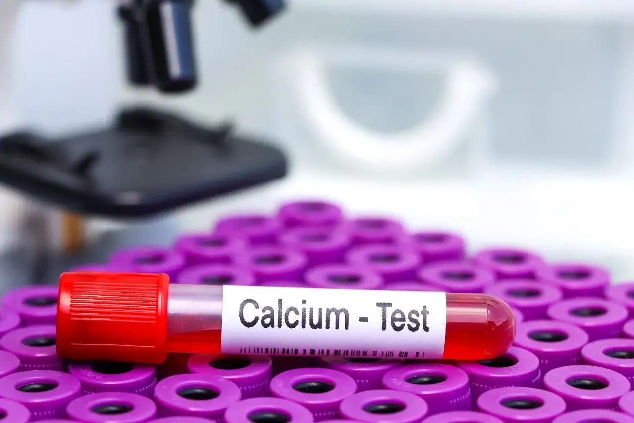 Wysoki wapń we krwi? Rozszyfruj wynik i zadbaj o zdrowie