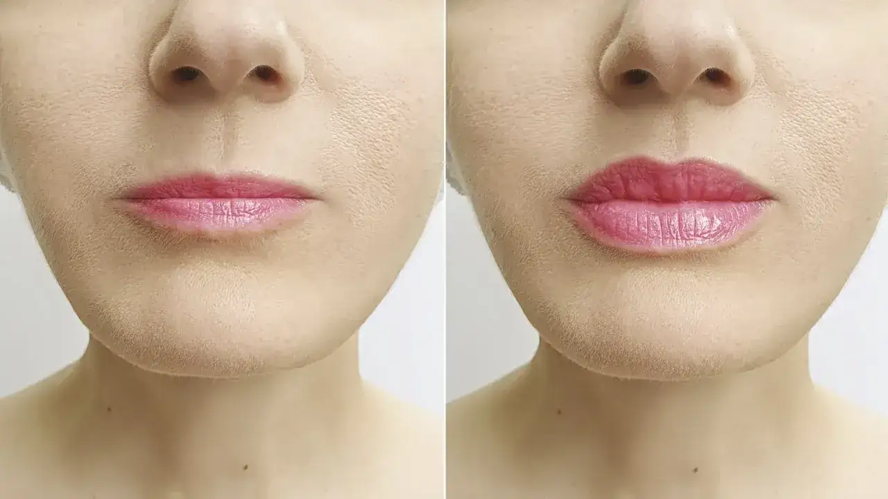 Powiększanie ust Lublin – gdzie najlepiej i co warto wiedzieć