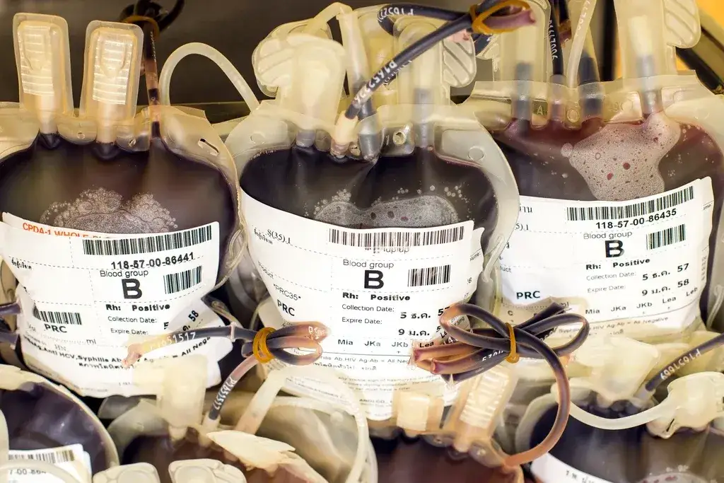 Kiedy odkryto grupy krwi? Fascynująca historia i znaczenie dla medycyny