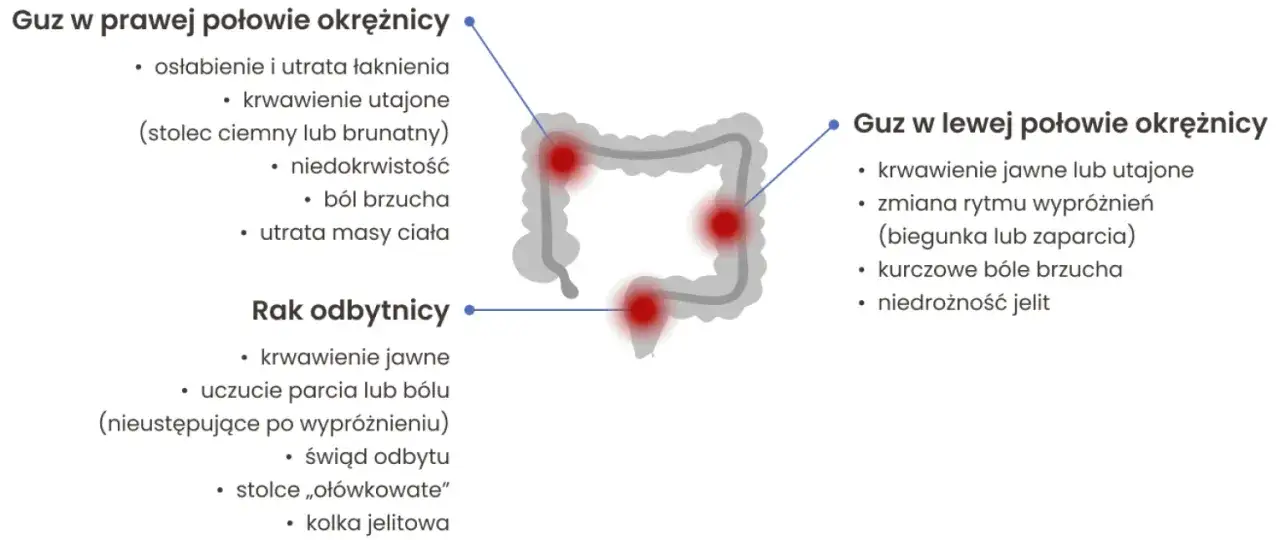 Objawy chorego jelita grubego - nie bagatelizuj tych sygnałów zdrowotnych