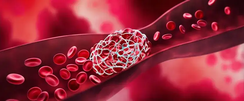 Leki rozrzedzające krew: rodzaje, działanie i bezpieczeństwo poradnik