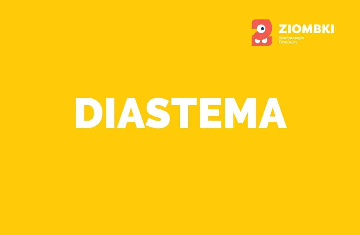 Jak się nazywa przerwa między zębami i dlaczego warto ją znać