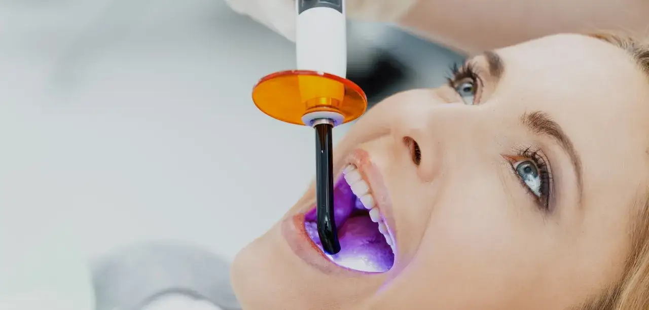 Jak wygląda wybielanie zębów u dentysty? Odkryj skuteczne metody i efekty