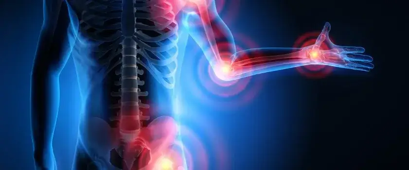 Bóle reumatyczne objawy: Jak je rozpoznać i kiedy szukać pomocy