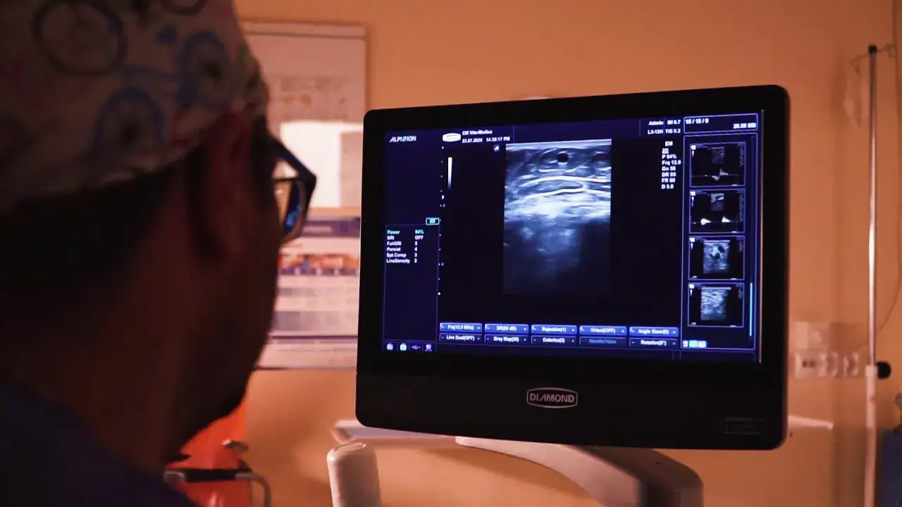 Jak wygląda badanie dopplera kończyn dolnych - co musisz wiedzieć?