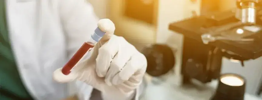 RDW-CV co to za badanie i dlaczego jest ważne dla zdrowia krwi