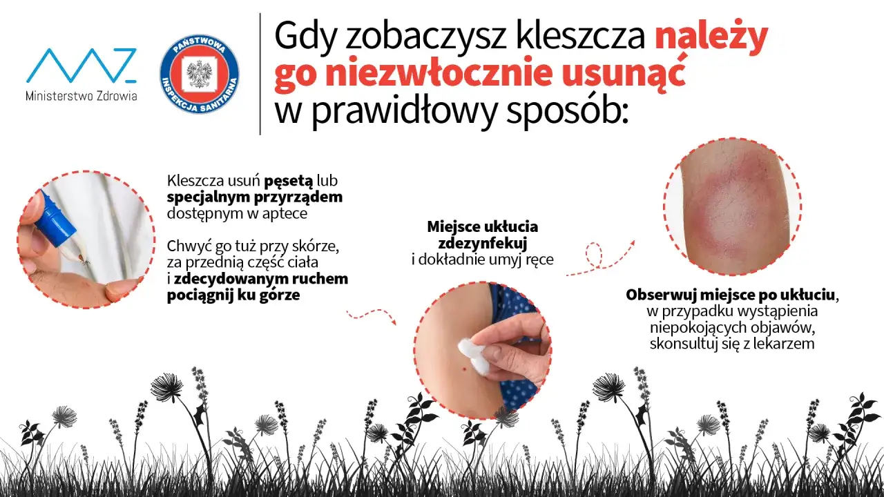 Kleszcz u człowieka – co robić, by uniknąć groźnych chorób i błędów?