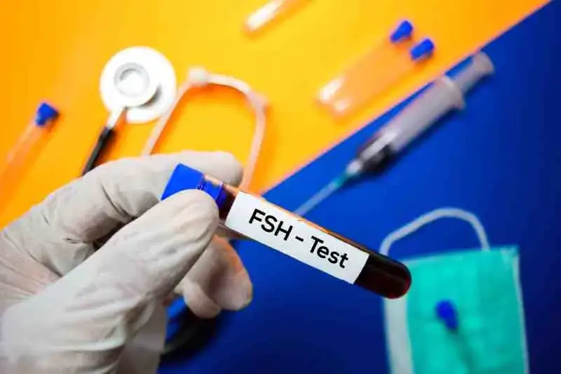 Badanie FSH u mężczyzn: co oznacza i dlaczego jest tak ważne w diagnozie