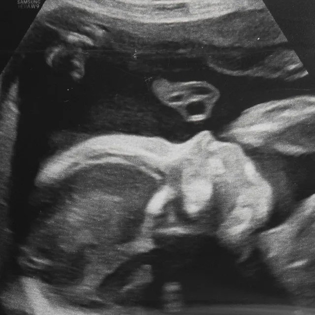 Mia • Cały album • Wszystkie utwory • Wykonawca