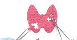 Tarczyca z puzzli, z brakującymi elementami i narzędziami chirurgicznymi. Symbolizuje problemy z hormonami tarczycy, np. niskie TSH.