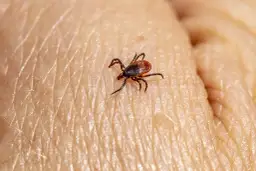 Skuteczne sposoby na odstraszanie kleszczy - naturalne metody ochrony