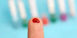 Blutuntersuchung bei Krebs: Wie Tests Leben retten können und was Sie wissen sollten