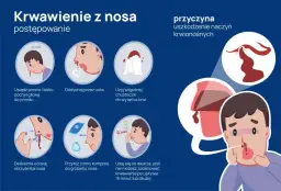 Krwawienie z nosa przyczyny: najczęstsze powody i co z nimi zrobić.