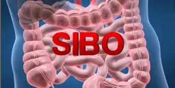 SIBO: przerost flory bakteryjnej i jego skutki dla zdrowia.