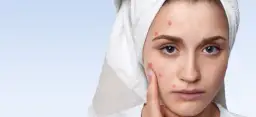 Czy po białku wyskakują pryszcze? Odkryj powody i rozwiązania