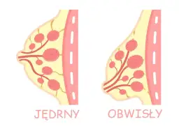 Ilustracja porównuje jędrne i obwisłe piersi, pokazując różnice w ich strukturze.