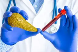 Lekarz w niebieskich rękawiczkach trzyma model trzustki i probówkę z krwią. Badanie poziomu amylazy co to jest, pomoże ocenić pracę trzustki.