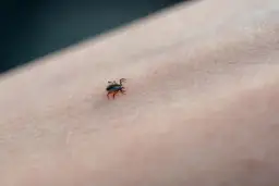 Do jakiego lekarza z kleszczem? Sprawdź, gdzie szukać pomocy!