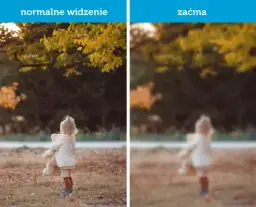 Czy przy zaćmie boli oko? Odkryj prawdę o bólu oczu