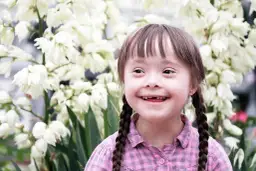 Czy zespół Downa jest dziedziczny? Prawda o dziedziczeniu tej choroby