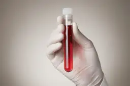 Niski poziom homocysteiny: 5 objawów i co to oznacza dla ciebie