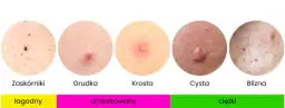 Jak pozbyć się pryszczy? Kompleksowy przewodnik po leczeniu
