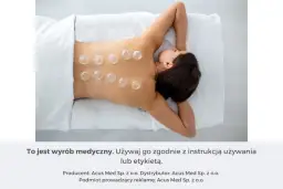 Kobieta z bańkami na plecach. Dowiedz się, jak stawiać bańki ogniowe, by poczuć ulgę.