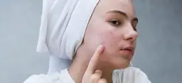 Jak pozbyć się pryszcza pod skórą i uniknąć blizn oraz bólu