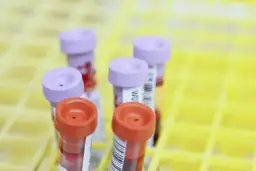 Krebsvorsorge Blutuntersuchung: Wie der PanTum Detect Test Leben retten kann