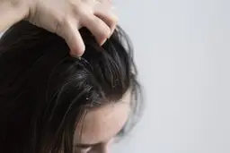 Jak używać peelingu, aby uzyskać gładką i zdrową skórę