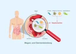 Symptome von Magen Darm: Warnzeichen einer ernsten Infektion erkennen