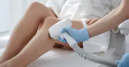 Ile trwa depilacja laserowa pach? Sprawdź, co wpływa na czas zabiegu