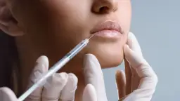 Ile kosztuje botox ust? Ceny zabiegów w Polsce i co wpływa na koszt