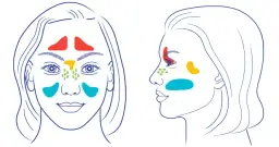 Die häufigsten Symptome einer Nasennebenhöhlenentzündung erkennen