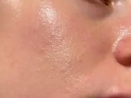 Effektive Mittel gegen ölige Gesichtshaut für einen matten Teint