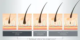 Optymalna długość włosków do depilacji woskiem: 5-10 mm?